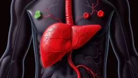 Imagem da notícia Saúde do Fígado em Foco: Superando a Doença Hepática Gordurosa Não Alcoólica